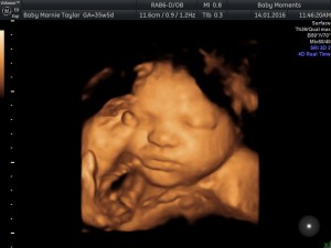 4D BABY SCAN
